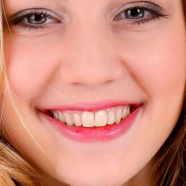 Before treatment